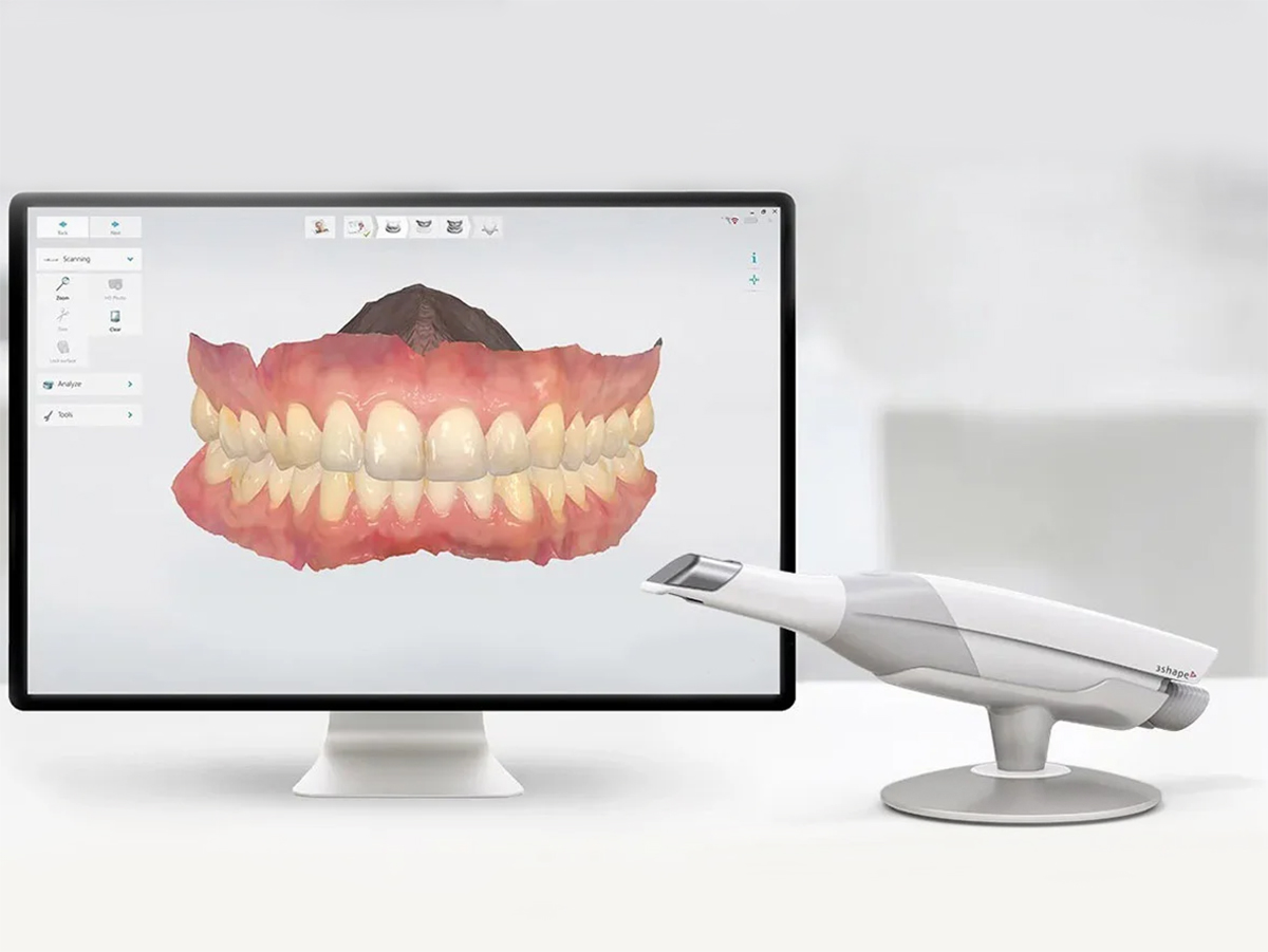 Digital intraoral scanner for precise and comfortable 3D dental impressions